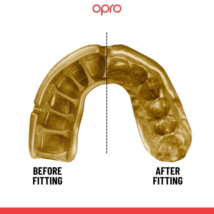 Opro Gold Self Fit Mouth Guard-FEUK